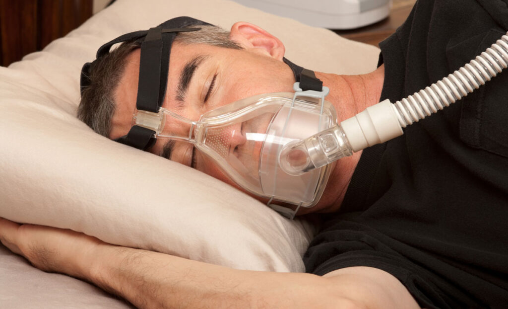 La apnea del sueño es una condición tratable mediante dispositivos que mejoran la respiración